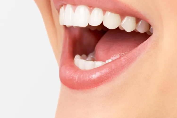 舌側矯正のセットアップモデルの製作